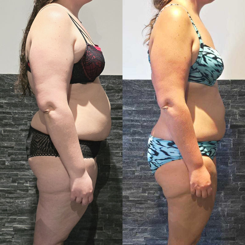 Transformation perte masse grasse importante femme en coaching à distance
