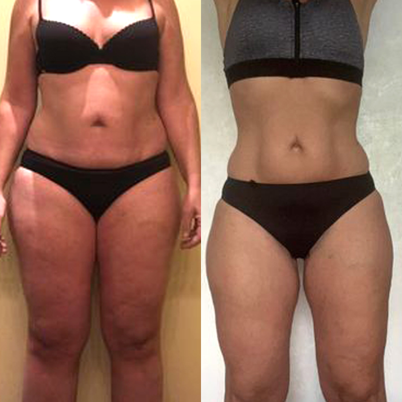 Transformation corporelle masse grasse en masse musculaire femme en 12 mois